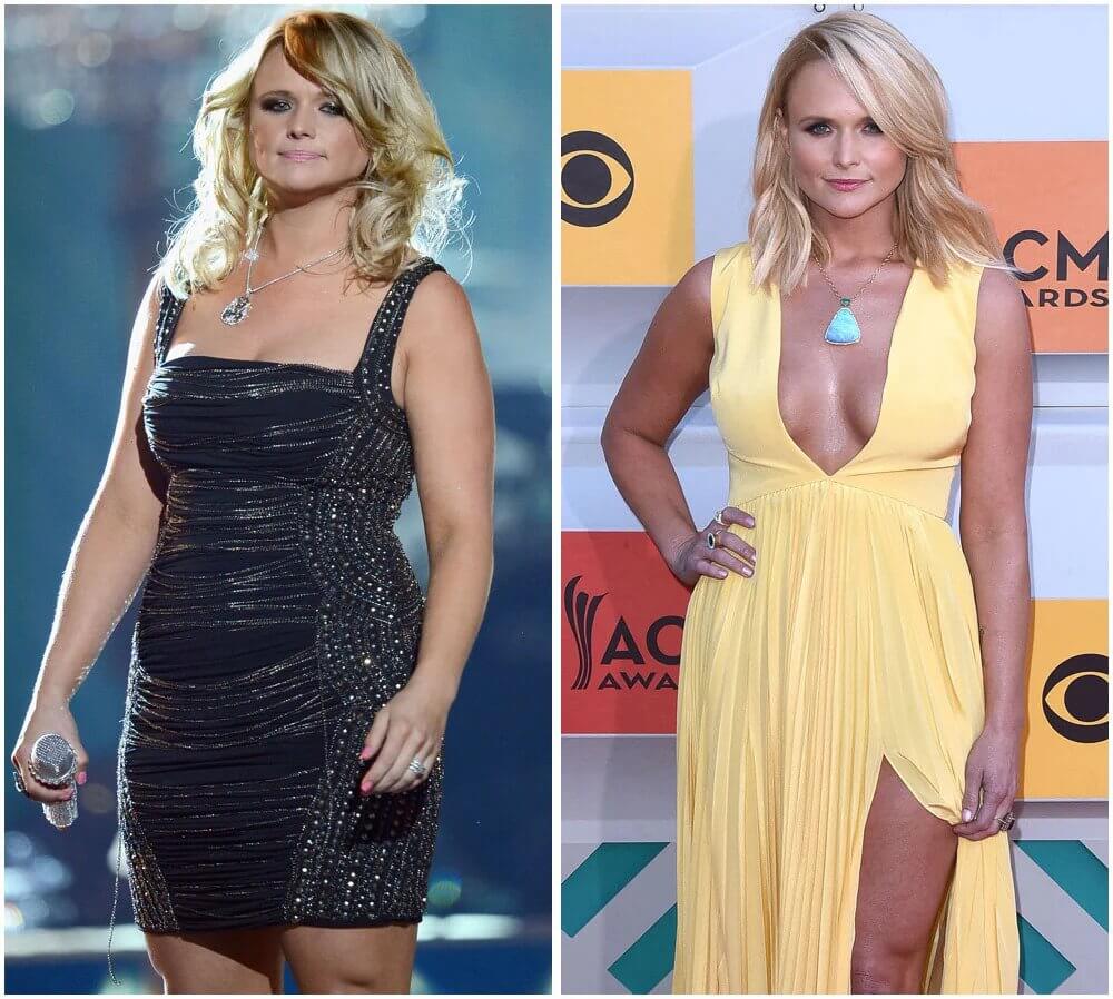 Miranda Lambert Before After